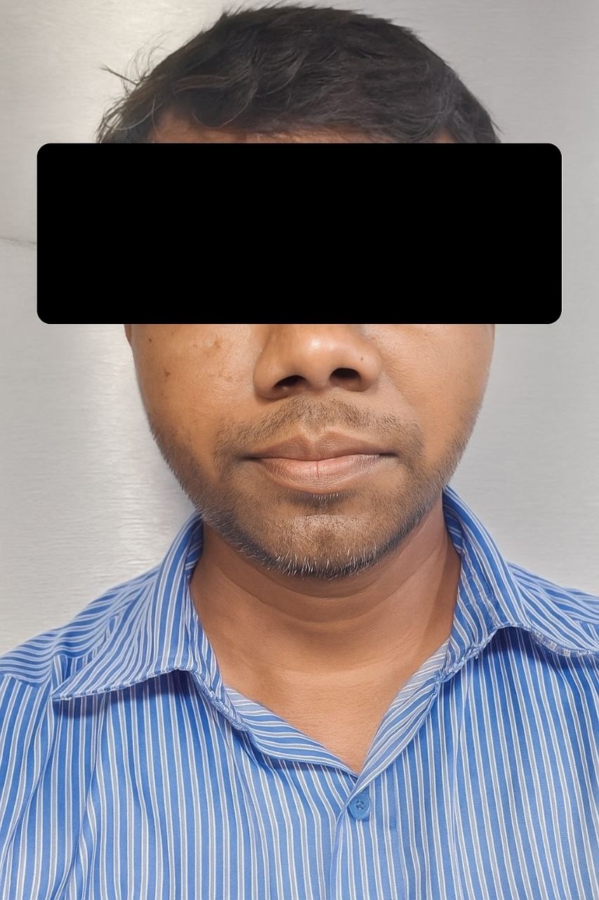 Parotid 10