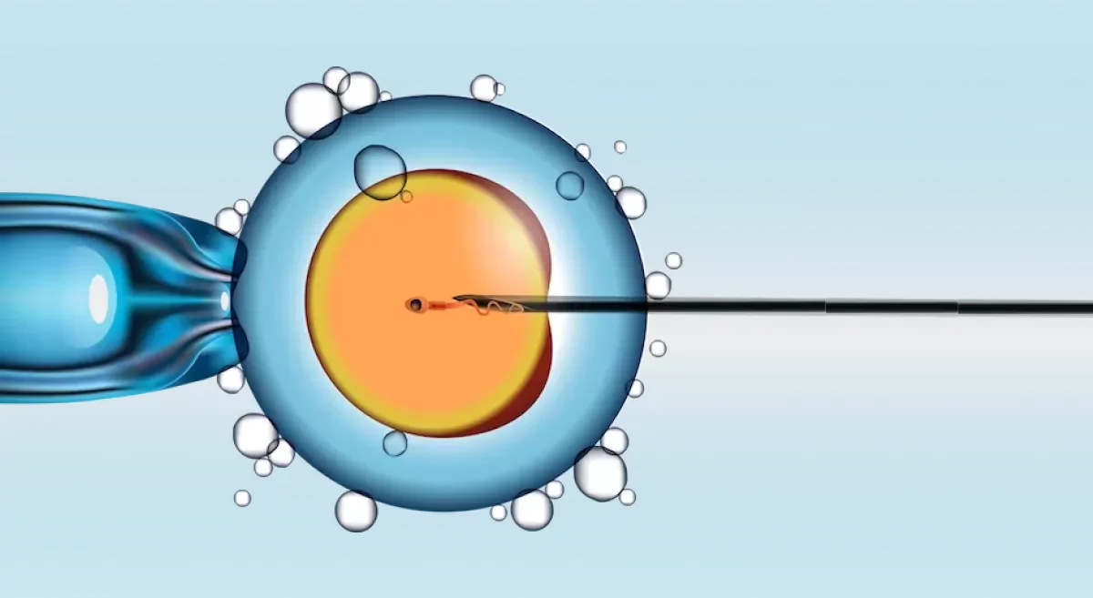 IUI vs IVF