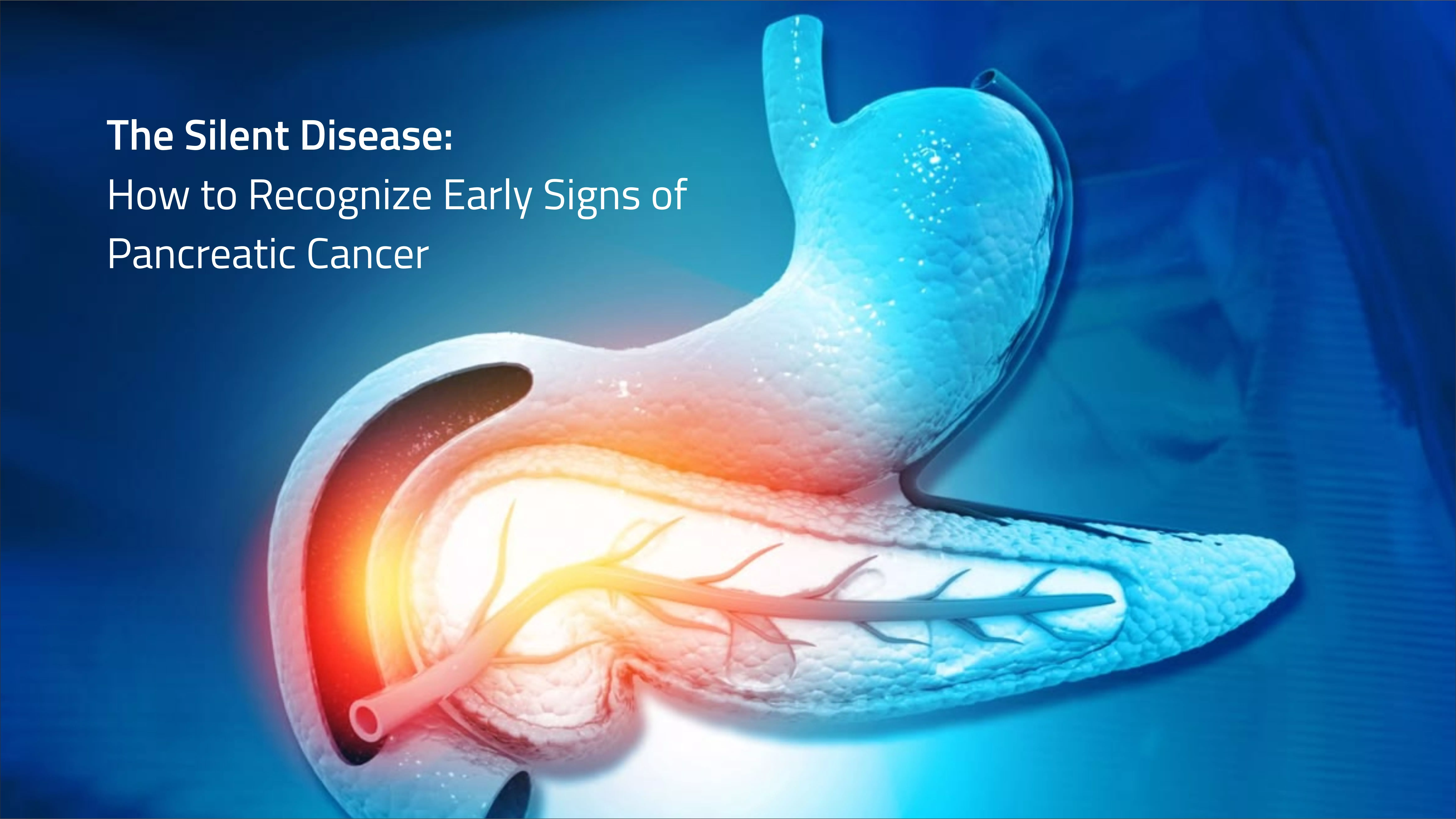 Pancreatic Cancer
