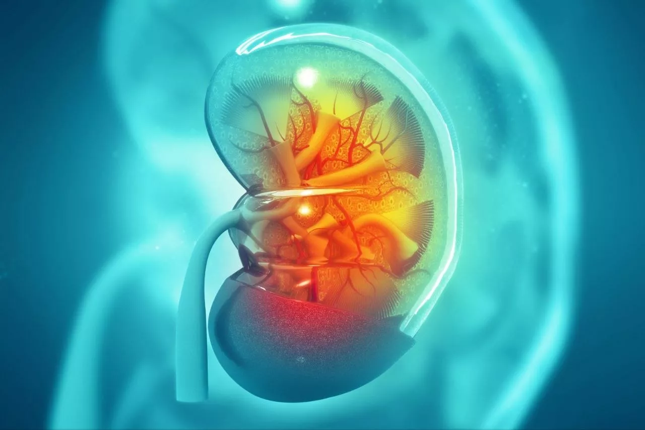 Atypical Hemolytic Uremic Syndrome
